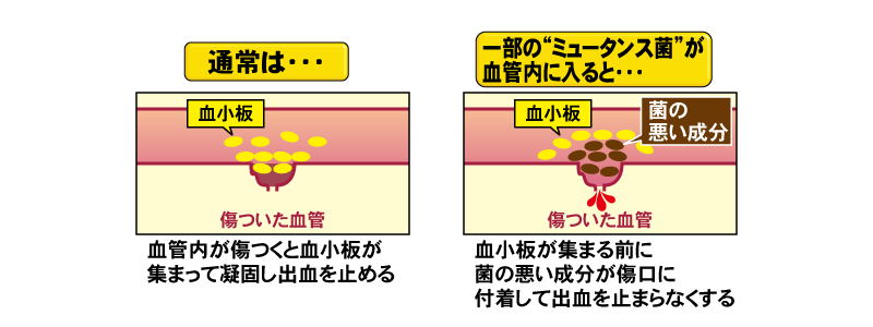 菌の悪い成分によって出血が止まらなくなる血管