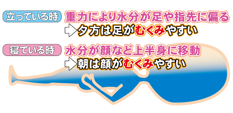 朝は顔がむくみますが、だんだんととれる　夕方になると足や指がむくみます