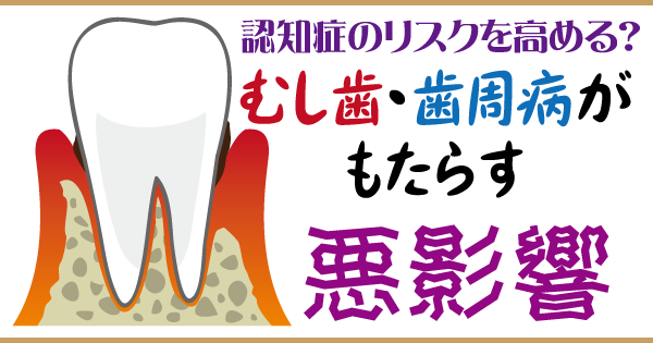 認知症のリスクを高める？「むし歯」「歯周病」がもたらす悪影響