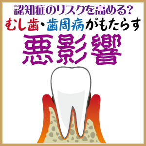 認知症のリスクを高める？「むし歯」「歯周病」がもたらす悪影響